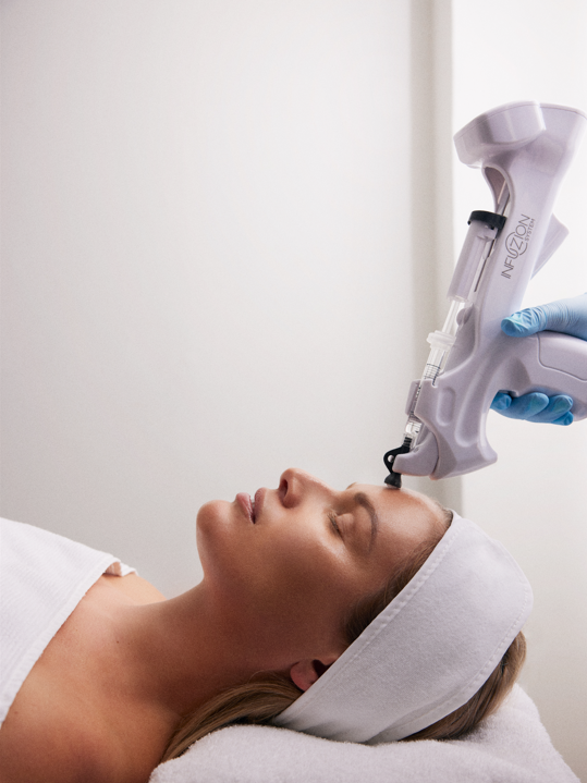 Infuzion®-Behandlung im Gesicht